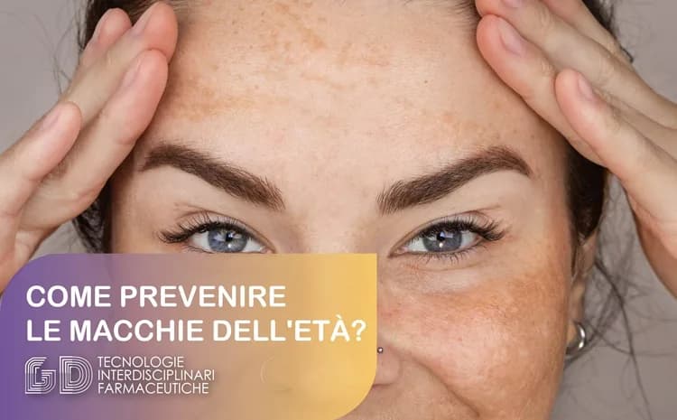 Lentigo senili. Prevenire le macchie dell'età dovute al sole