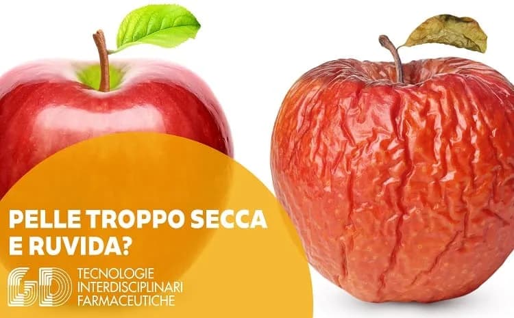 Pelle troppo secca e ruvida? Rimedi per la xerosi cutanea