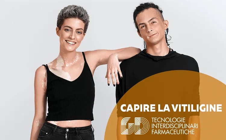 Capire la vitiligine