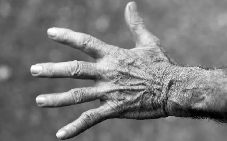 Vene delle mani: un problema estetico
