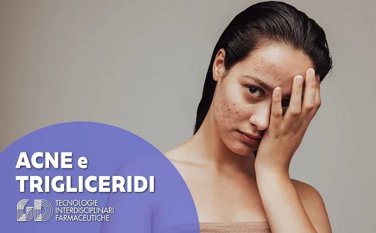 Terapia per l'acne: tra gli effetti collaterali l'aumento dei trigliceridi