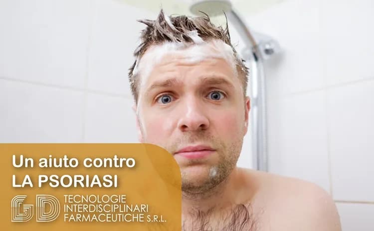 Psoriasi del cuoio capelluto: come prendersi cura di capelli e cuoio capelluto?