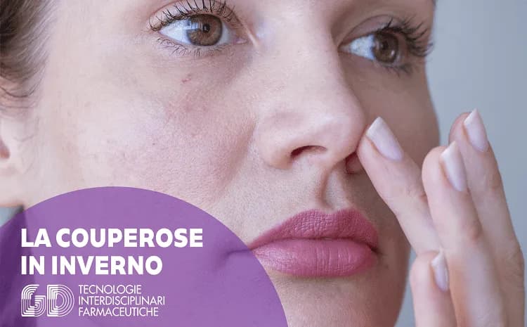 La couperose in inverno