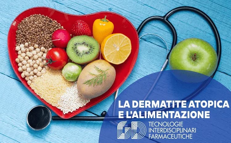 Dermatite atopica e alimentazione