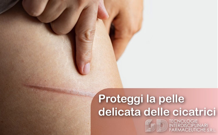 proteggere cicatrici dal sole